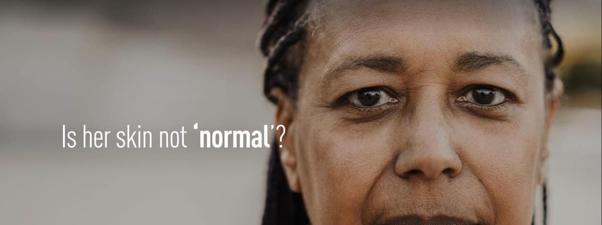 Unilever removed "normal," gained 5.5B impressions